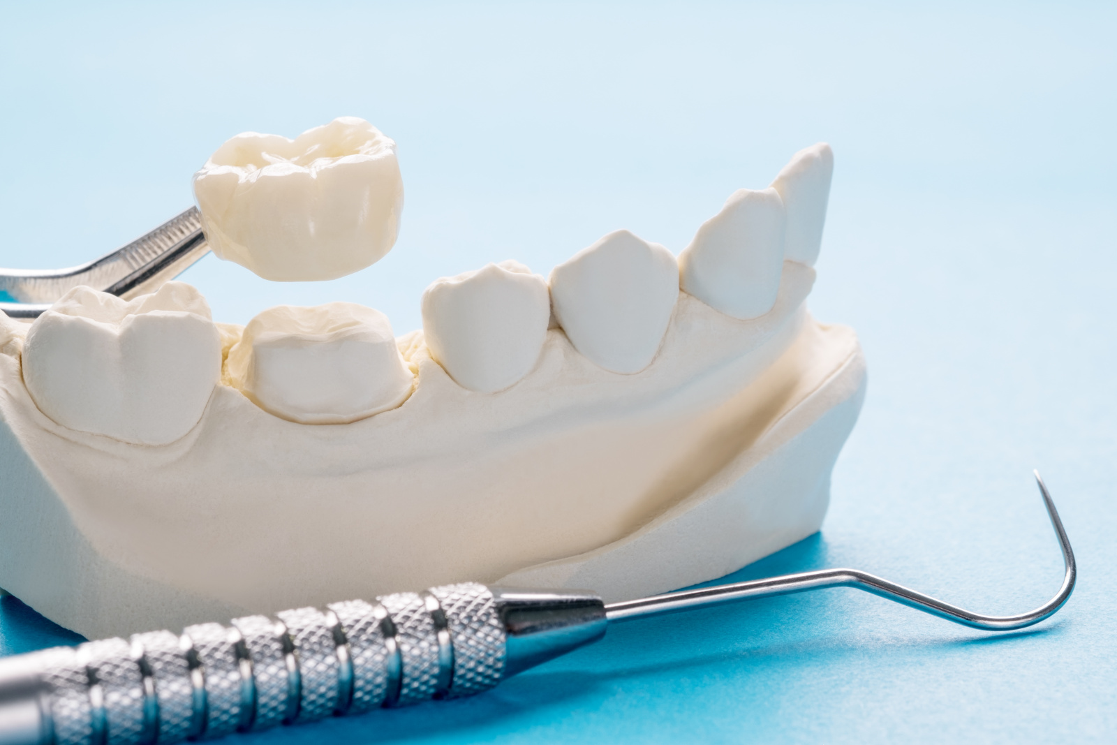 Как выровнять зубы без брекетов? Протезирование коронками