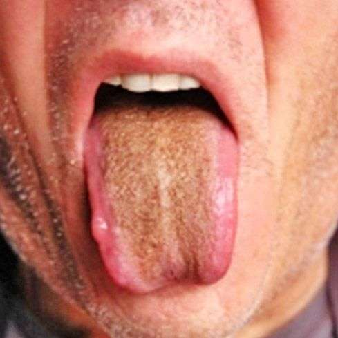 Почему человек жует свой язык