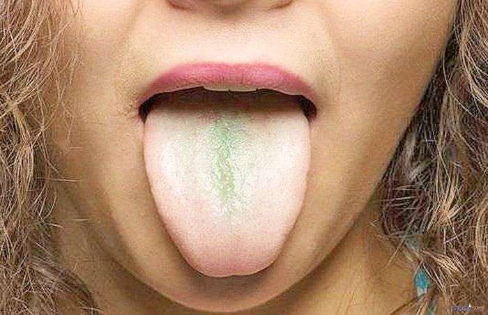 Зеленый язык
