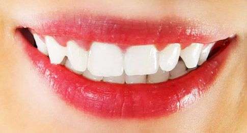 здоровые белые зубы