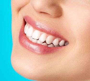 Вредно ли отбеливание для зубов?