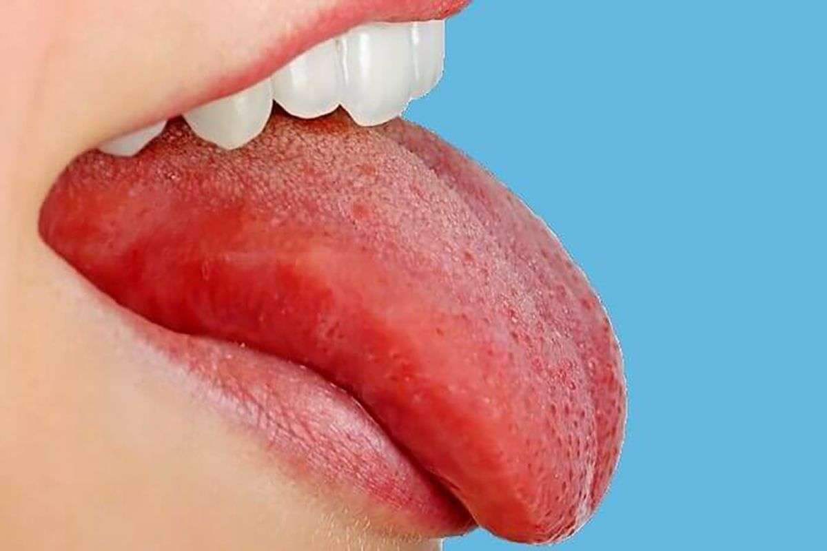 Болит язык сбоку: причины