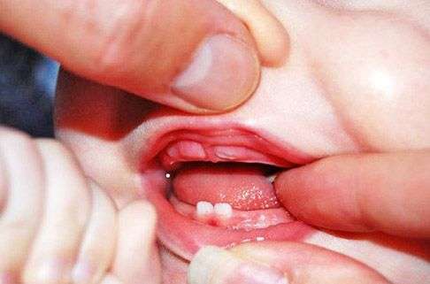 первые зубки у малыша