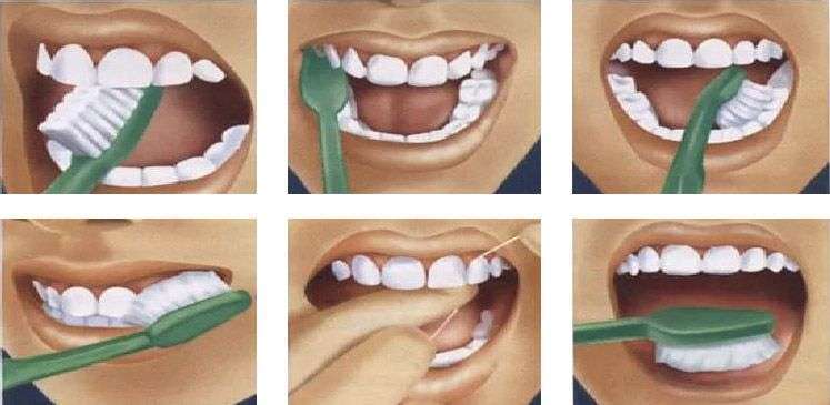 Схема - как правильно чистить зубы?