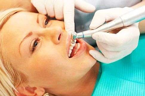 Причины образования зубного камня 